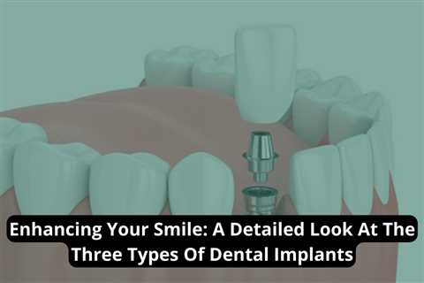 Enhancing Your Smile: A Detailed Look At The Three Types Of Dental Implants