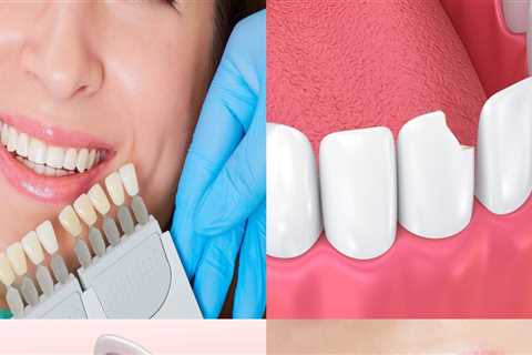 Financing Options for a Smile Makeover