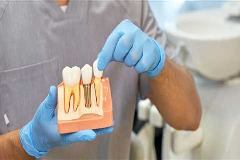 Understanding Dental Implants In Austin, TX: The Latest Advances In Dental Technology