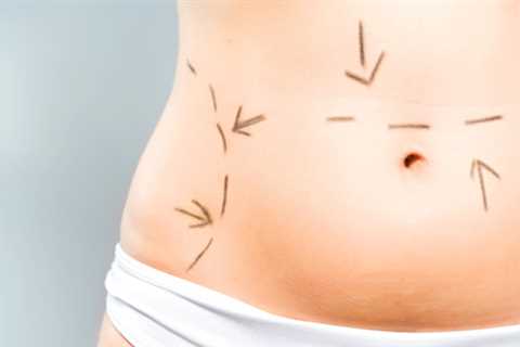Ink & Incisions: The Relationship Between Tattoos and Plastic SurgeryInk & Incisions: