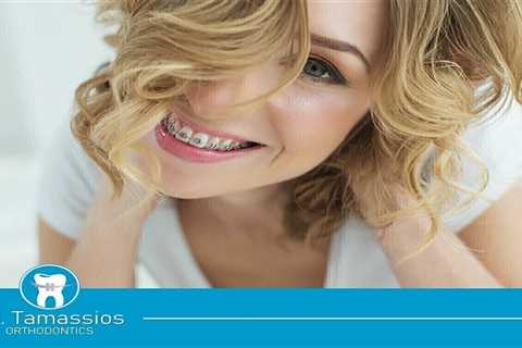 Standard post published to Tamassios Orthodontics - Orthodontist Nicosia, Cyprus at November 20,..