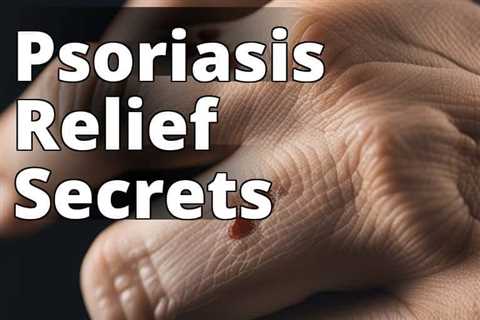The Ultimate Guide to Using CBD Oil for Psoriasis Relief: Unlocking the Potential Benefits