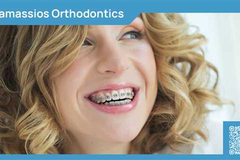 Standard post published to Tamassios Orthodontics - Orthodontist Nicosia, Cyprus at November 25,..
