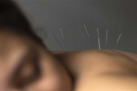 ACUPUNCTURE FOR MENOPAUSE SYMPTOMS: WHAT YOU NEED TO KNOW