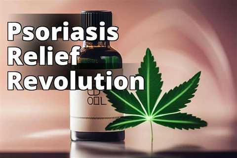 Unveiling the Power of CBD Oil: The Ultimate Psoriasis Relief Solution