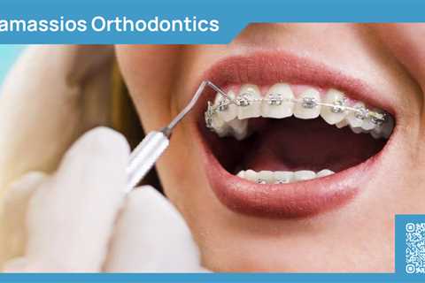 Standard post published to Tamassios Orthodontics - Orthodontist Nicosia, Cyprus at December 10,..