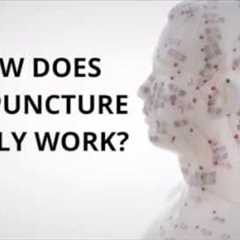 How Does Acupuncture Really Work? - Three Moon Acupuncture