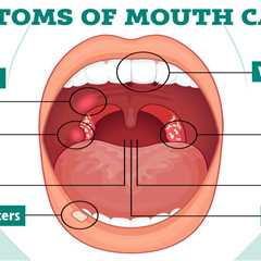 How to Check Your Mouth for Signs of Cancer – Simple Self-Examination Guide