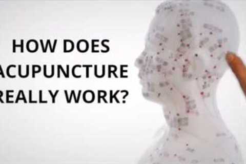 How Does Acupuncture Really Work? - Three Moon Acupuncture