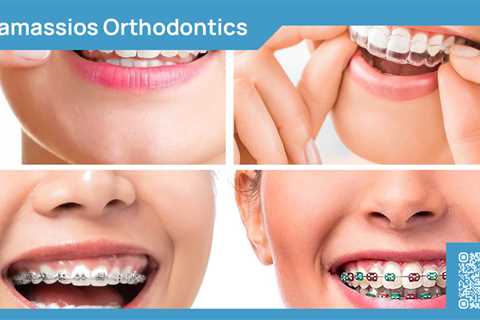 Standard post published to Tamassios Orthodontics - Orthodontist Nicosia, Cyprus at January 07,..