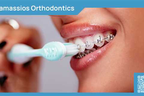 Standard post published to Tamassios Orthodontics - Orthodontist Nicosia, Cyprus at January 18,..