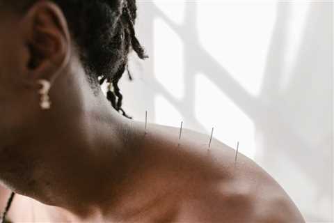 USING ACUPUNCTURE FOR PANIC DISORDER SYMPTOM RELIEF