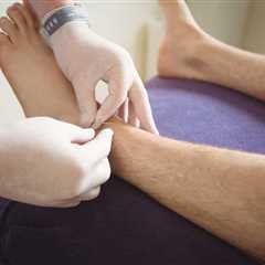 HOW TO USE ACUPUNCTURE FOR FOOT PAIN RELIEF