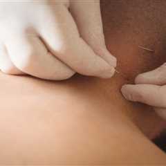 THE BENEFITS OF ACUPUNCTURE FOR CHRONIC PAIN IN POLYMYALGIA RHEUMATICA PATIENTS ON LOW-DOSE..