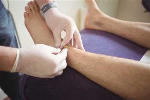 HOW TO USE ACUPUNCTURE FOR FOOT PAIN RELIEF
