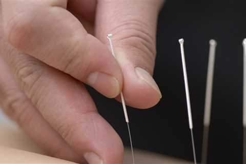 THE BENEFITS OF ACUPUNCTURE FOR MENOPAUSE-RELATED VAGINAL DRYNESS