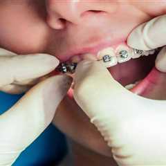 Exploring the Surge in Demand for Orthodontic Services: Causes and Implications