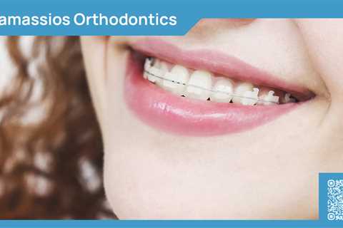 Standard post published to Tamassios Orthodontics - Orthodontist Nicosia, Cyprus at March 23, 2024..
