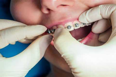 Exploring the Surge in Demand for Orthodontic Services: Causes and Implications
