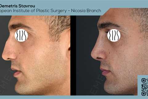 Standard post published to Dr. Demetris Stavrou - European Institute of Plastic Surgery - Nicosia..