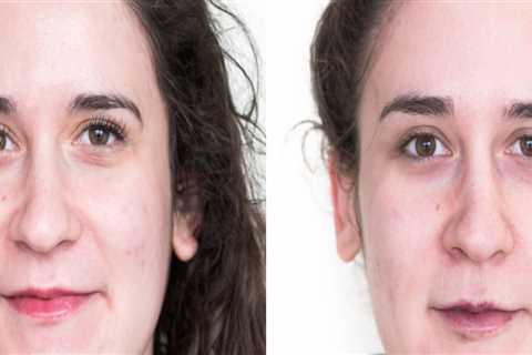 Can you see results after 1 facial?