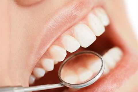 Regular Dental Checkups In Perth, Belmont, Cloverdale, Burswood