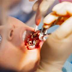 Understanding the Timing: When to Remove Wisdom Teeth