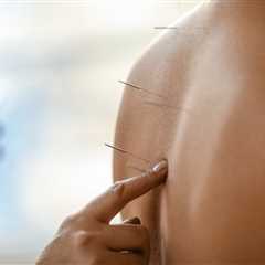Acupuncture and Sports Medicine: Enhancing Performance and Supporting Recovery