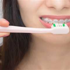 Effective Ways to Maintain Oral Hygiene With Braces