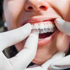 Understanding the Benefits of Invisalign for Teens and Adults