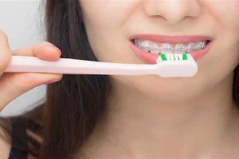 Effective Ways to Maintain Oral Hygiene With Braces