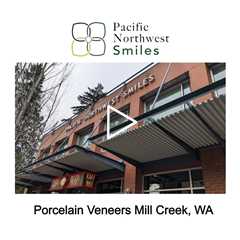 Porcelain Veneers Mill Creek, WA - Pacific NorthWest Smiles - (425) 357-6400