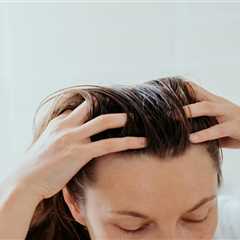 Winning the Battle Against Dandruff: Expert Advice You Need