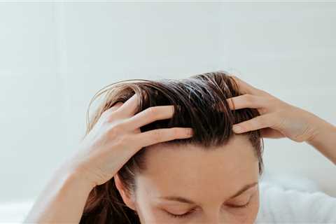 Winning the Battle Against Dandruff: Expert Advice You Need