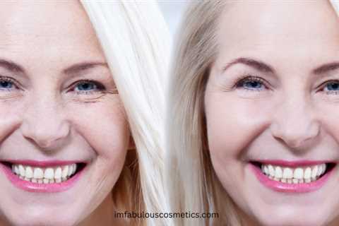 Combatting the Effects of Ozempic Face: A Guide to Restoring Youthful Skin