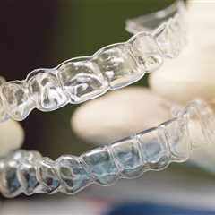 How Long is the Typical Wear Time for Clear Aligners?