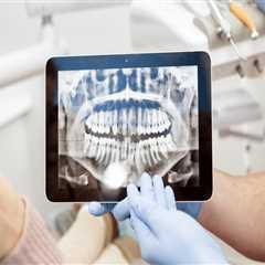 Understanding The Importance Of Dental X-Rays For Your Oral Health In Thornhill