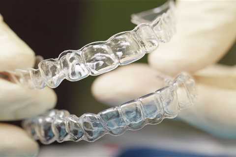 How Long is the Typical Wear Time for Clear Aligners?