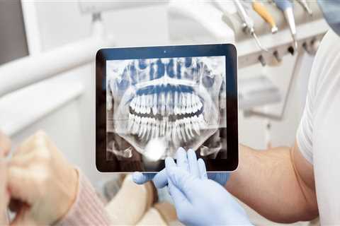 Understanding The Importance Of Dental X-Rays For Your Oral Health In Thornhill