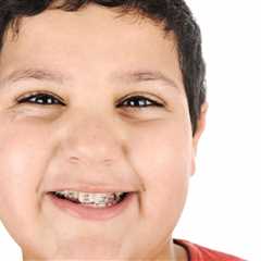 3 Reasons Your Child Might Need Braces