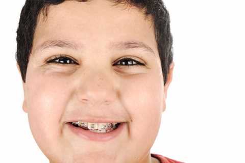 3 Reasons Your Child Might Need Braces