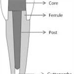 Post and core