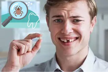 Can Lyme Disease Make Your Teeth Fall Out? Exploring the Connection - Dentist Decode