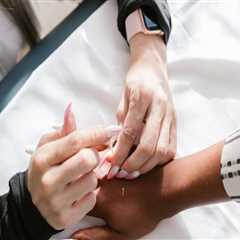Why Dry Needling In Las Vegas Is Gaining Attention In Holistic Health Circles