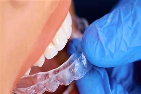 How An Invisalign Dentist Can Help You Weigh The True Cost Of Braces In Summerville