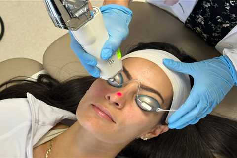 Revolutionizing Skin Care: ClearSilk Laser Offers New Hope for Rosacea Sufferers