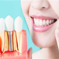 Restoring Confidence: The Importance Of Dental Implants For A Complete Smile In Ashburn