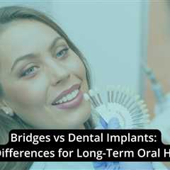 Bridges vs Dental Implants: Key Differences for Long-Term Oral Health