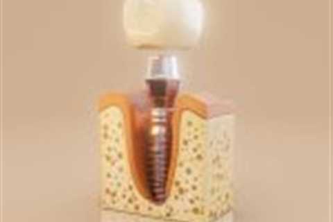 What Is a Dental Implant Made Of? Materials and Benefits