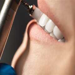 The Essential Benefits of Regular Teeth Cleaning for Optimal Oral Health
